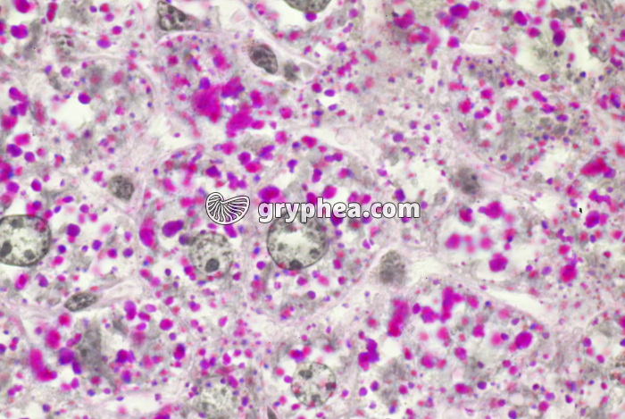 Cellules foie - glycogène x200 - gryphea.org